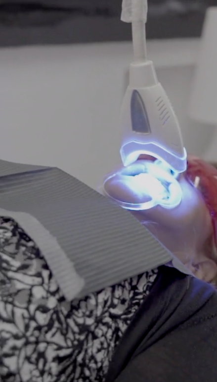 Teeth Whitening (Service)