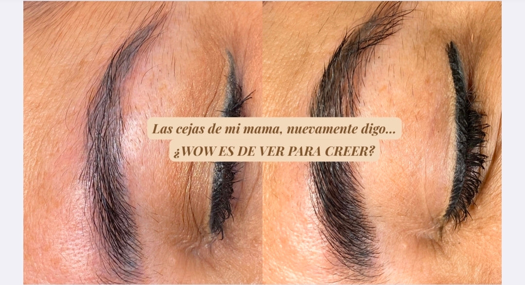 Brow Gen Theraphy (1 Session) (Service)