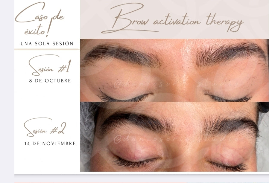 Brow Gen Theraphy (1 Session) (Service)