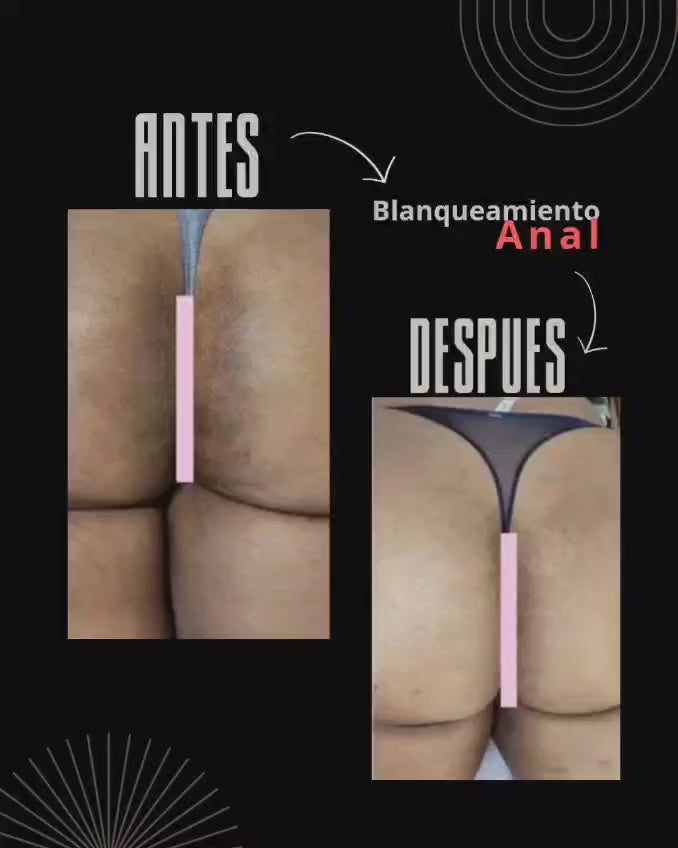 Intimate Whitening 2 sessions or 2 areas (Service)